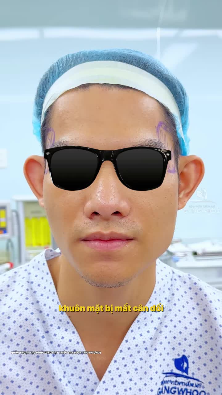 30 phút độn thái dương, can thiệp nhỏ nhưng mang lại hiệu quả tối đa