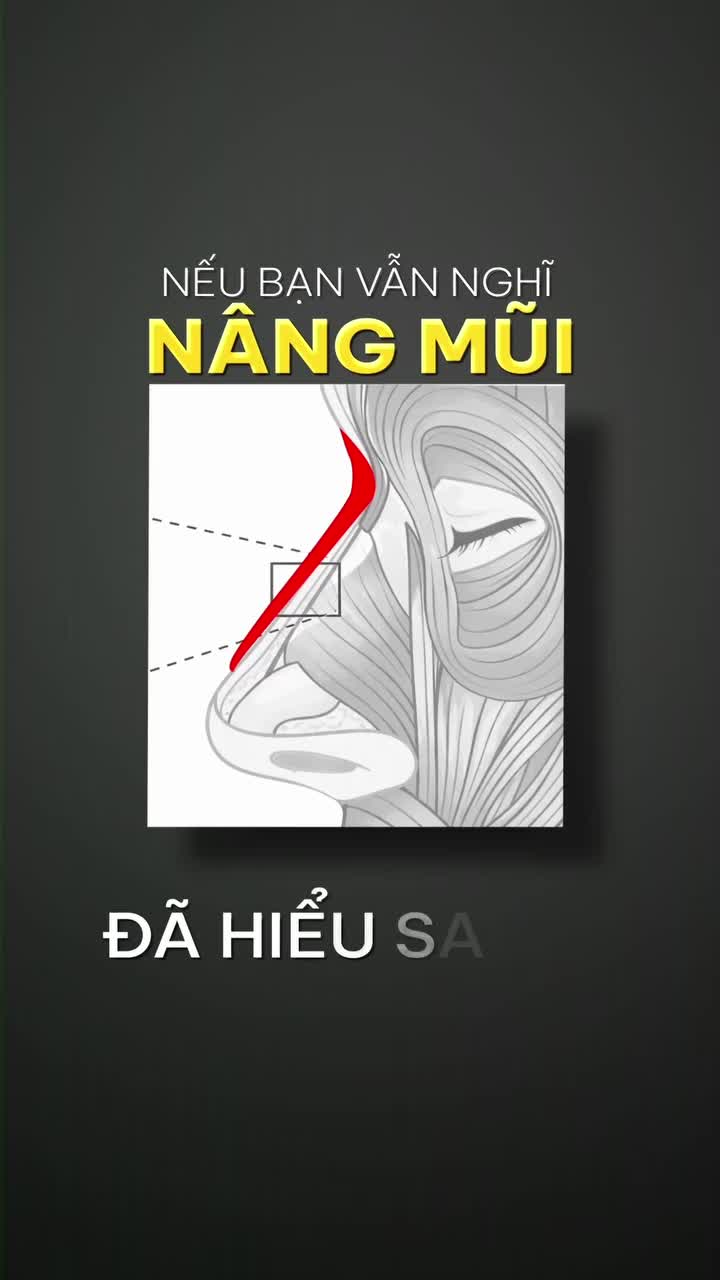 Sự thật về nâng mũi mà nhiều chị đẹp chưa biết???