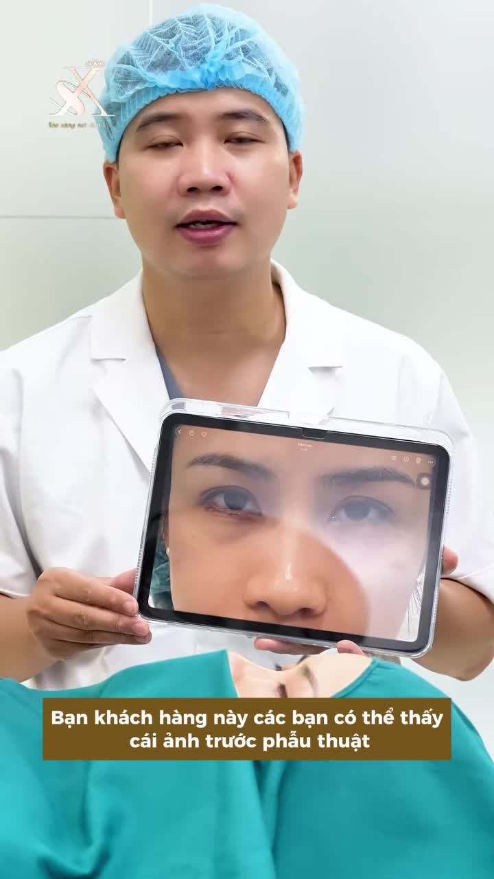 TRƯỜNG HỢP NÀO CẦN GHÉP MỠ CẮT MÍ DƯỚI?