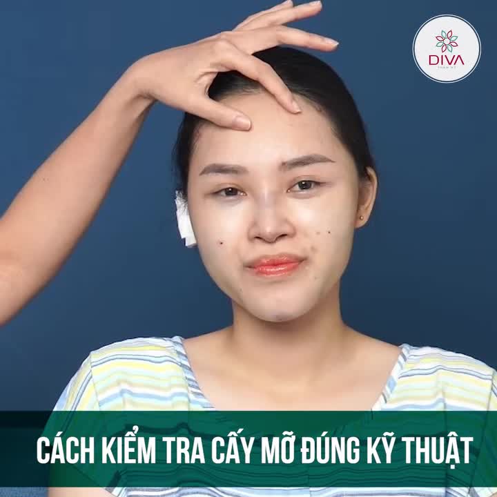 Cách kiểm tra xem bạn có được cấy mỡ đúng kỹ thuật hay không sau khi thực hiện?