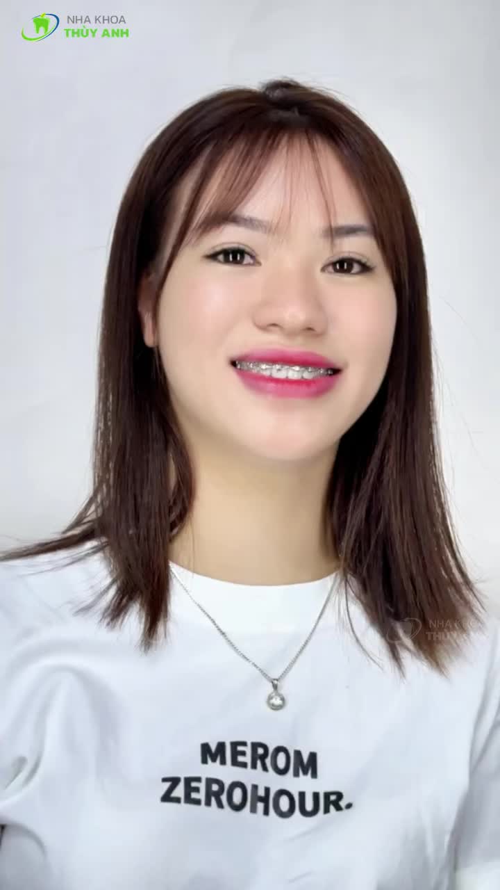 Thế nào là ngoài sự mong đợi??