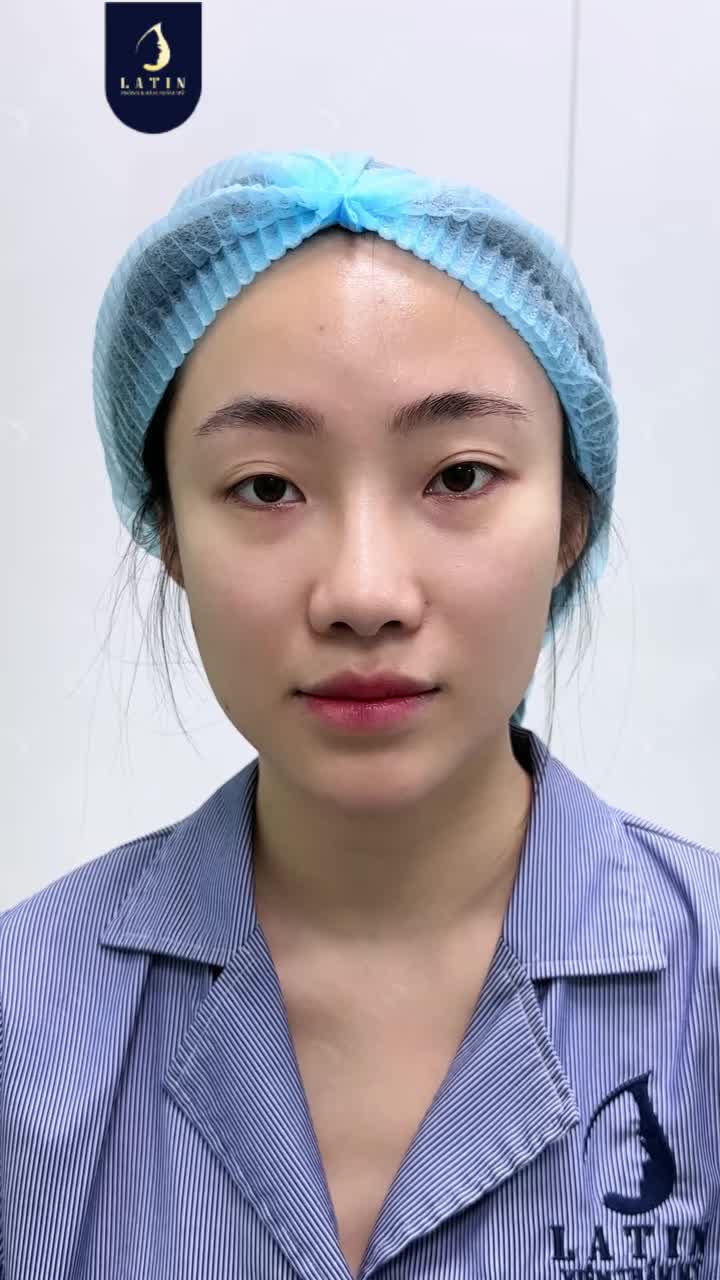 MÍ MỜ, NẾP MÍ CHƯA CÂN – LÀM SAO ĐỂ ÁNH NHÌN RÕ NÉT HƠN?