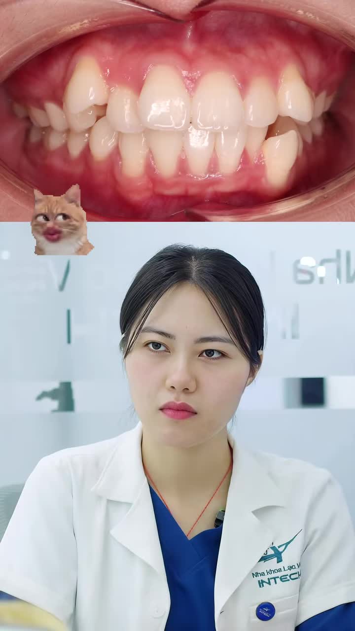 Niềng răng có giữ lại răng khểnh được không?