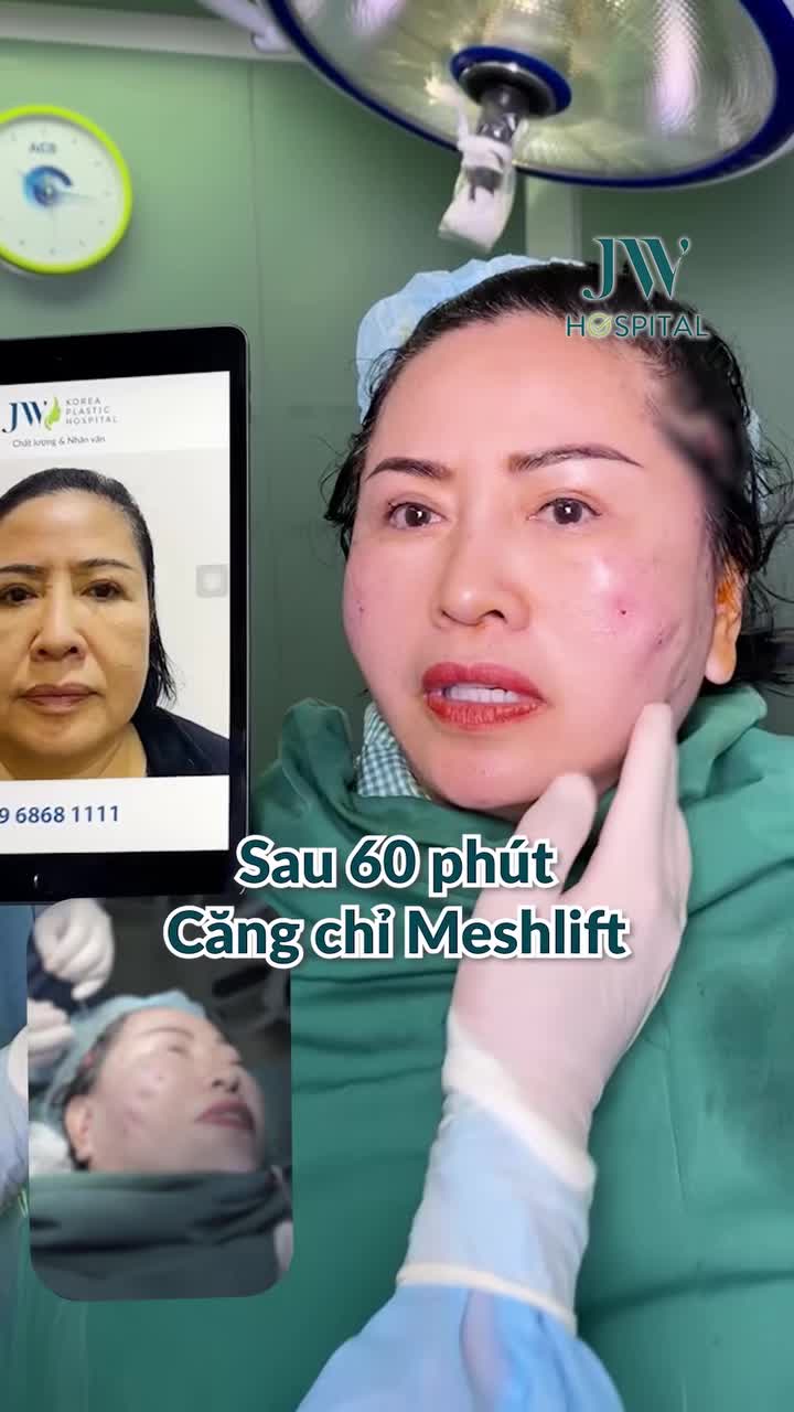 BÁC SĨ TÚ DUNG CĂNG CHỈ MESH LIFT CHO NỮ DOANH NHÂN U60 TRẺ HÓA 20 TUỔI SAU 60 PHÚT NGAY TRÊN BÀN MỔ