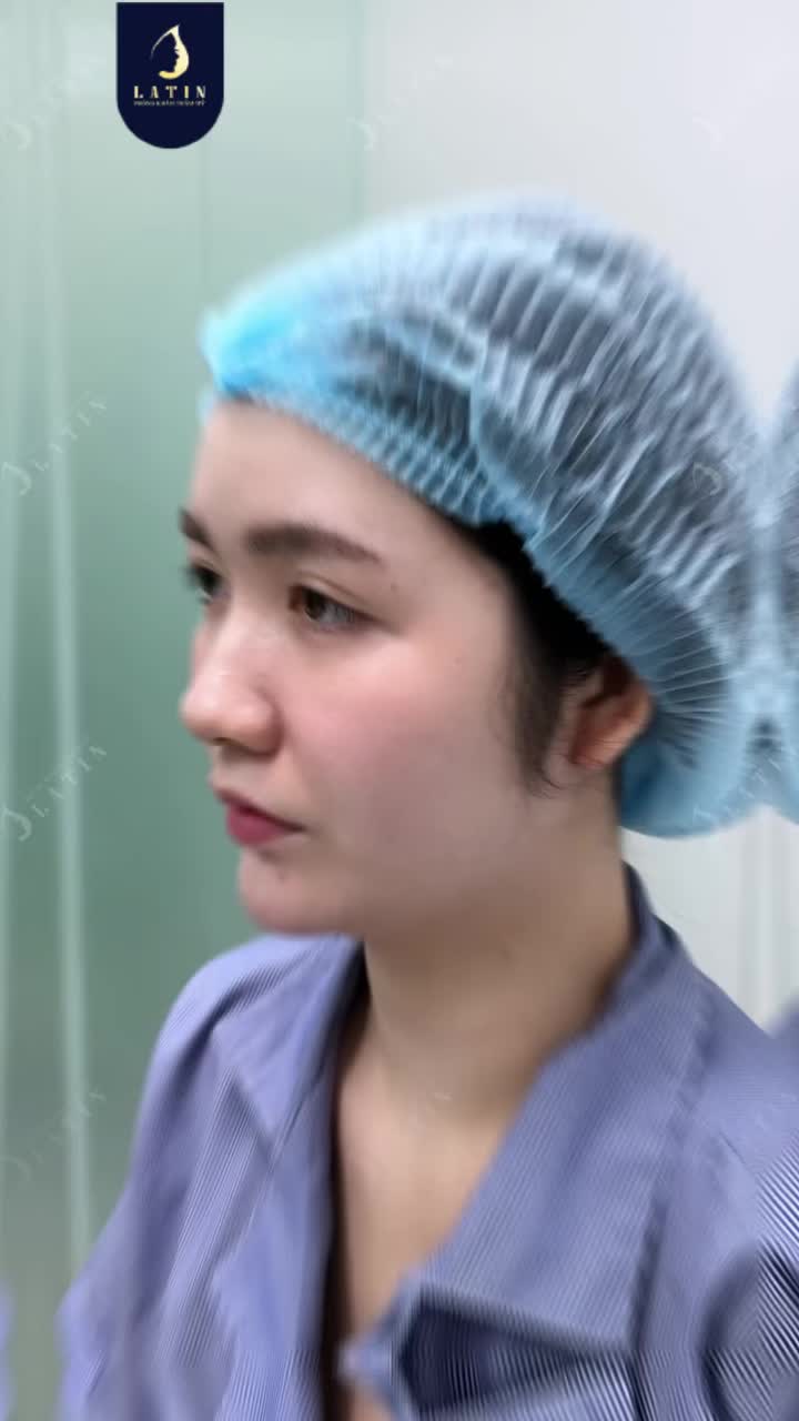 MẮT CÓ NẾP – MŨI CÓ DÁNG, SAU 10 NGÀY XINH NHƯ BÚP BÊ