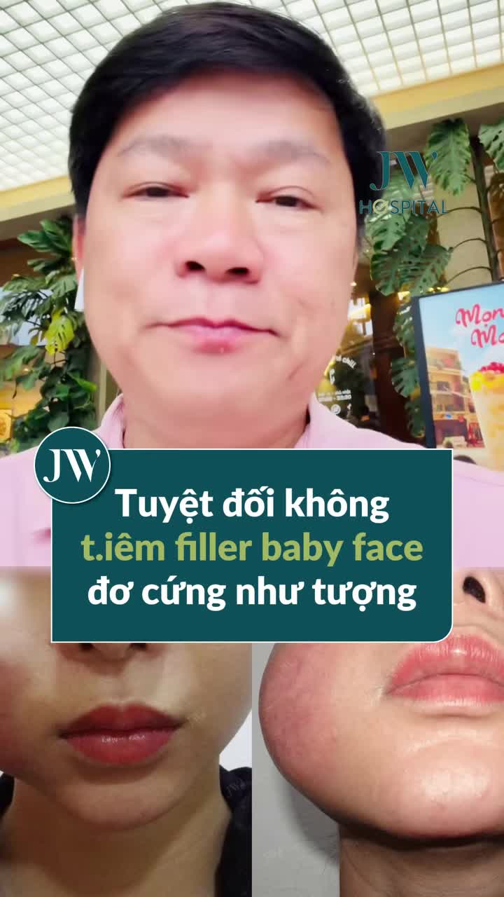BÁC SĨ TÚ DUNG CẢNH BÁO: TIÊM FILLER BABY FACE ĐỂ TRẺ HOÁ – CẨN THẬN CÀNG TI.ÊM NHIỀU, GƯƠNG MẶT CÀNG KHÓ CỨU!