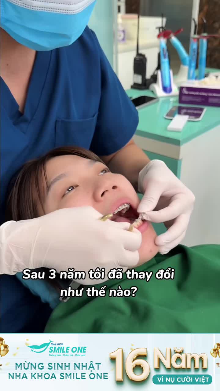 "Niềng răng thì thay đổi được gì chứ?"  Để Smile One cho anh thấy sau khi niềng thì thay đổi được gì nhaaaaa