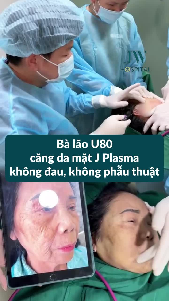 BÀ LÃO U80 LẶN LỘI TÌM ĐẾN BÁC SĨ TÚ DUNG CĂNG DA MẶT J PLASMA TRẺ HÓA 20 TUỔI KHÔNG PHẪU THUẬT