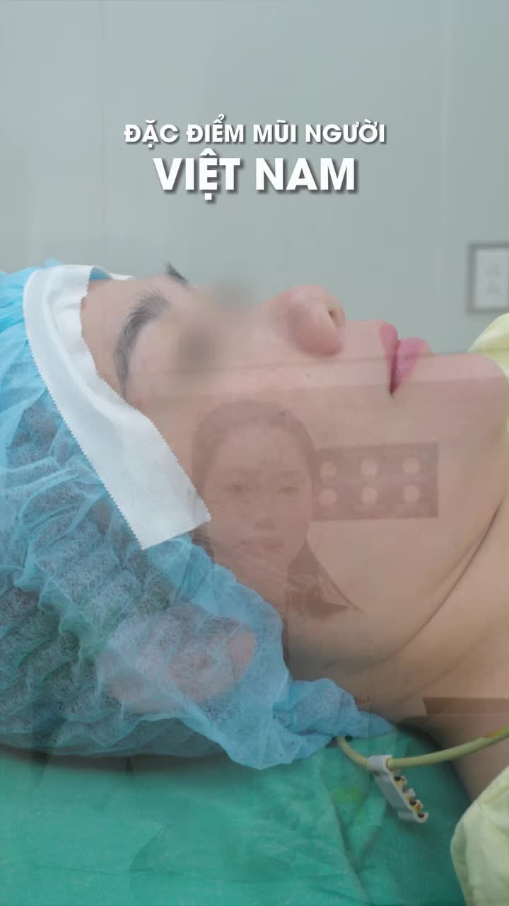 Dáng mũi nào đang được khách hàng ưa chuộng nhất?