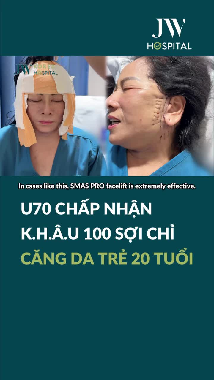 BÁC SĨ TÚ DUNG CĂNG DA MẶT SMAS PRO CHO BÀ CHỦ U70 BÌNH THUẬN TRẺ 20 TUỔI CHỒNG CON NHẬN KHÔNG RA