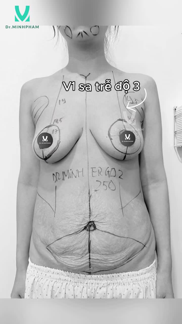 KIẾN TẠO VÓC DÁNG TOÀN DIỆN CHO MẸ BỈM SAU SINH