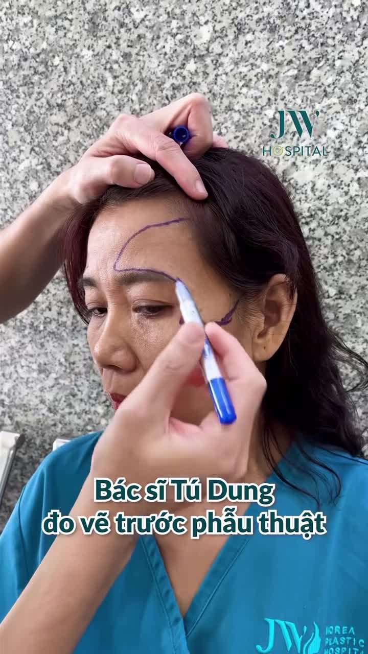 NỮ VIỆT KIỀU U50 VỀ NƯỚC XÓA CAU MÀY, MÁ HÓP, TRẺ LIỀN 20 TUỔI, SẸO VÔ HÌNH TẠI BỆNH VIỆN JW