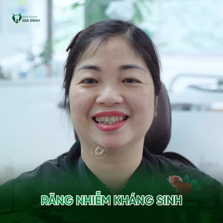 4 TRƯỜNG HỢP NÊN CÂN NHẮC THẨM MỸ RĂNG SỨ