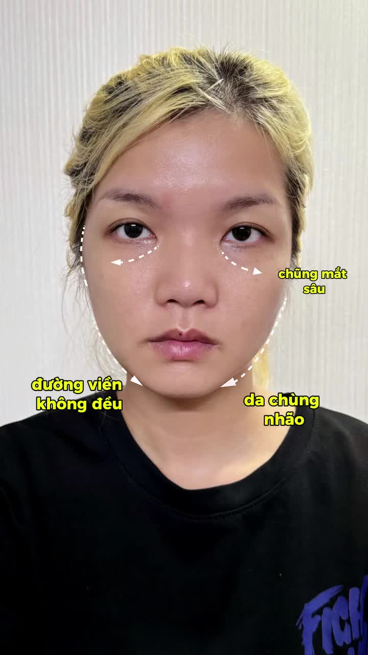 LỘT XÁC TOÀN DIỆN: ĐẸP HÀI HÒA, TRẺ HÓA BẤT NGỜ
