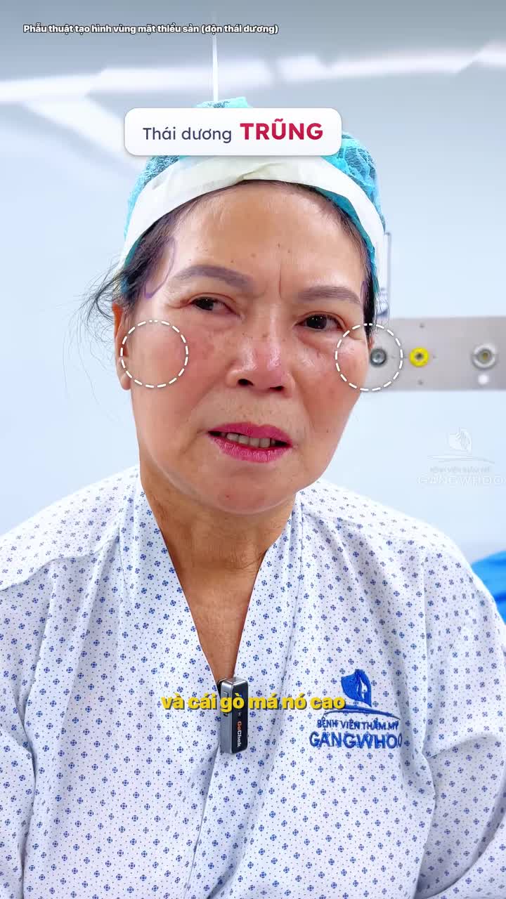 Độn thái dương xong có đi diễn văn nghệ được không?