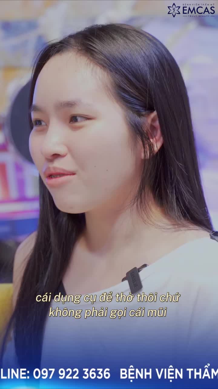 Góc review từ tâm: Cảm nhận thực tế của khách hàng sau khi nâng mũi SVF tại EMCAS.