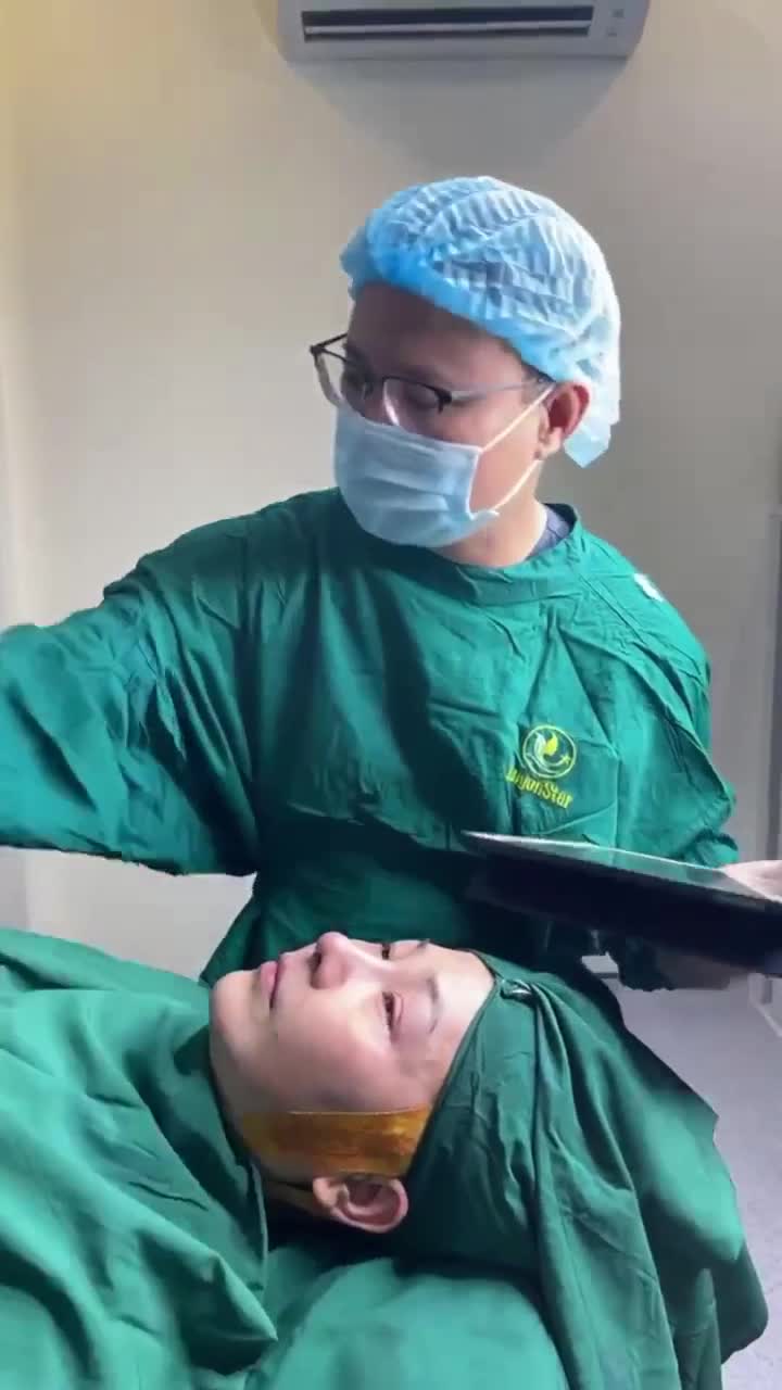 Kết quả NÂNG MŨI CẤU TRÚC + CẤY MỠ RÃNH MŨI MÁ