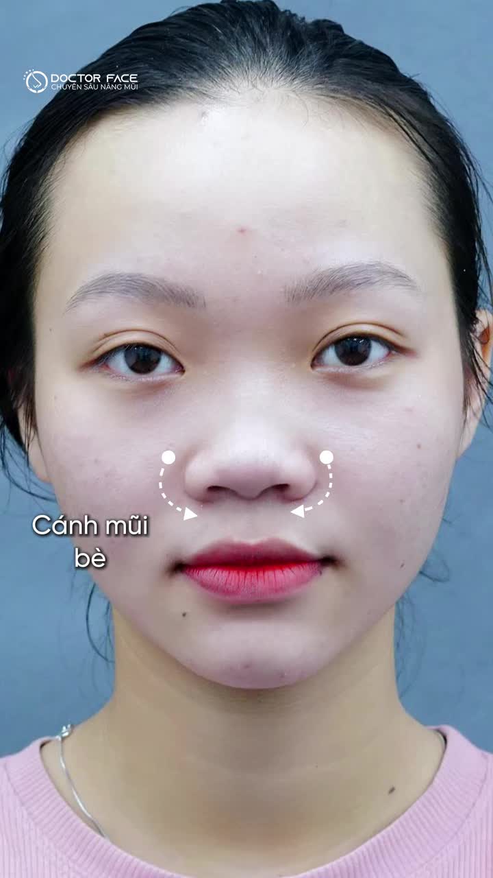 Before đã hiền, after vẫn hiền mà lại cuốn