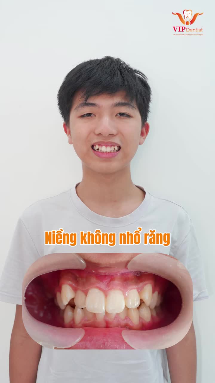 CHÀO ĐÓN NHỮNG KHÁCH HÀNG MỚI LỰA CHỌN NIỀNG RĂNG TẠI VIP DENITST!