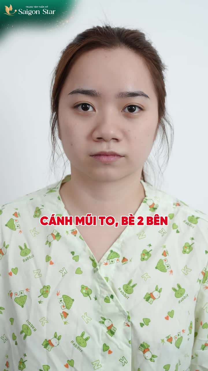 THAY VÌ MUA IPHONE 18 THÌ KHÁCH HÀNG SAIGON STAR QUYẾT ĐỊNH ĐẦU TƯ CHO MÌNH 1 VẺ ĐẸP BỀN VỮNG