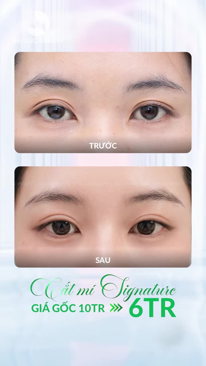 SIÊU ƯU ĐÃI 20.10 - CẮT MÍ SIGNATURE CHỈ CÒN 6TR