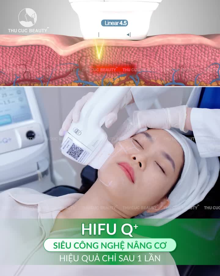HIFU Q+: NÂNG CƠ TRẺ HÓA - ĐỊNH HÌNH V-LINE CHUẨN Y KHOA