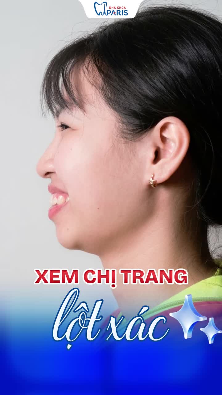 THÁO NIỀNG LÀ THÁO TỰ TI – U30 CÀNG NIỀNG SỚM, CÀNG ĐẸP SỚM!