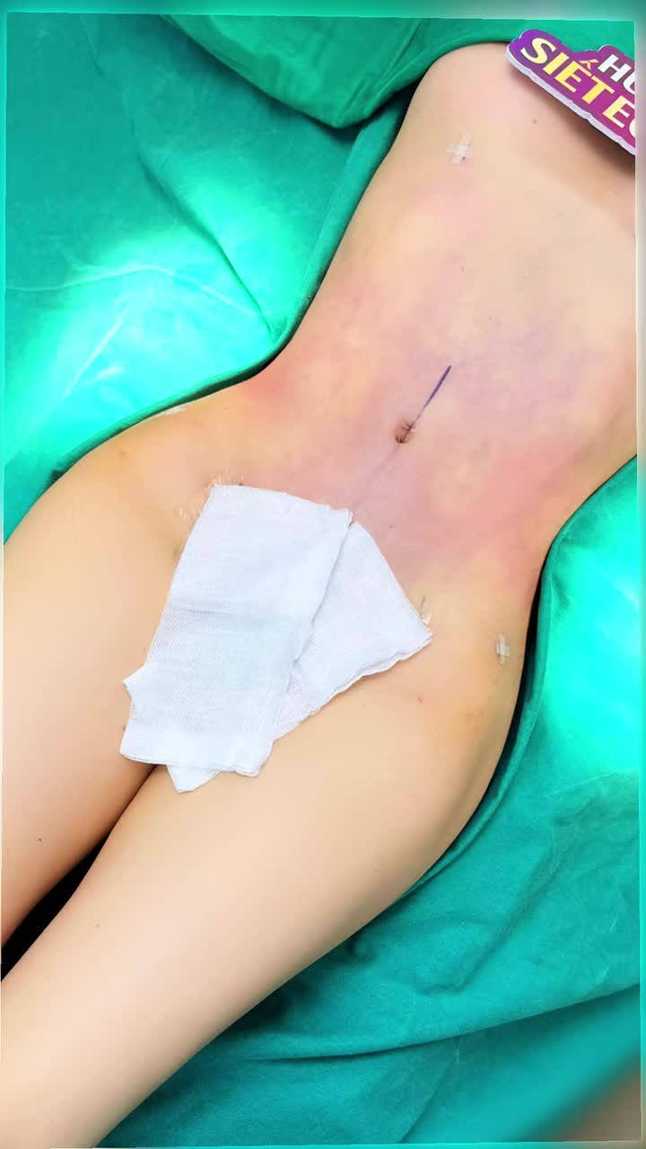 NHÌN BODY SAU SIẾT EO 360°, KHÁCH PHẢN ỨNG RA SAO?