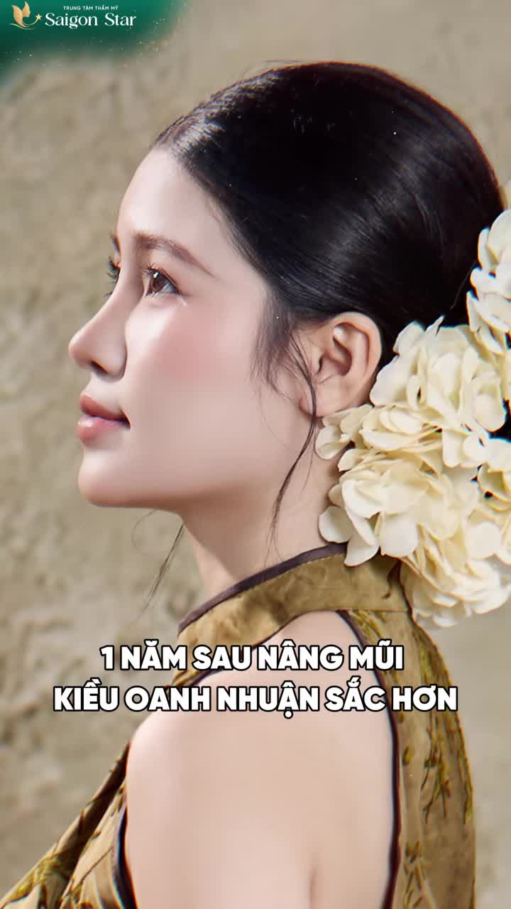 FEEDBACK SAU 1 NĂM: Nâng mũi đẹp nhất là khi người ta thấy bạn xinh hơn, chứ không nhận ra bạn đã nâng mũi