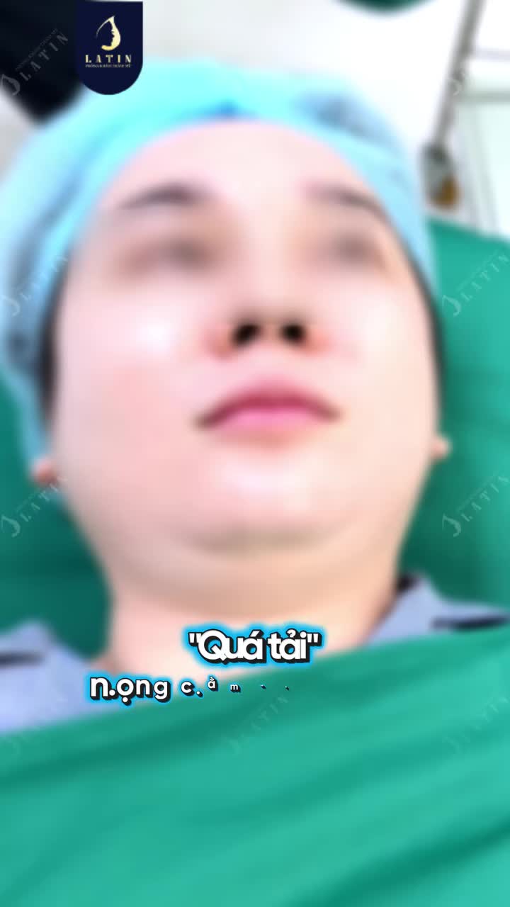 "QUÁ TẢI" NỌNG - LẤY LẠI VIỀN HÀM SAU 30 PHÚT THỰC HIỆN