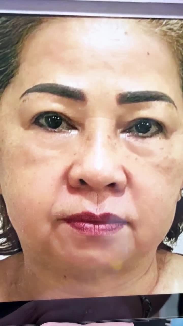 CHIÊM NGƯỠNG: Nhan sắc quý cô U70 Sài Thành sau 10 ngày CĂNG DA MẶT SMAS PRO tại JW TRẺ HƠN CẢ CON GÁI