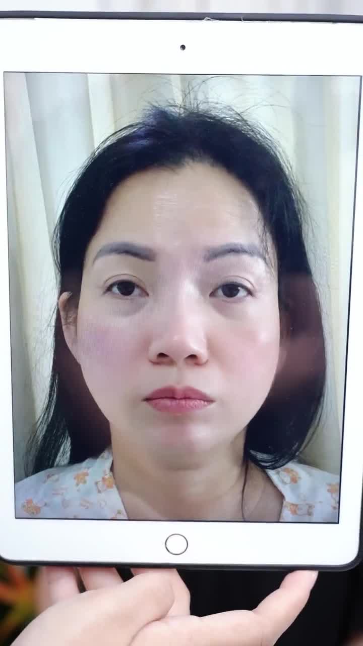 RẠNG RỠ SAU 10 NGÀY VỚI COMBO TRẺ HÓA ĐÔI MẮT: