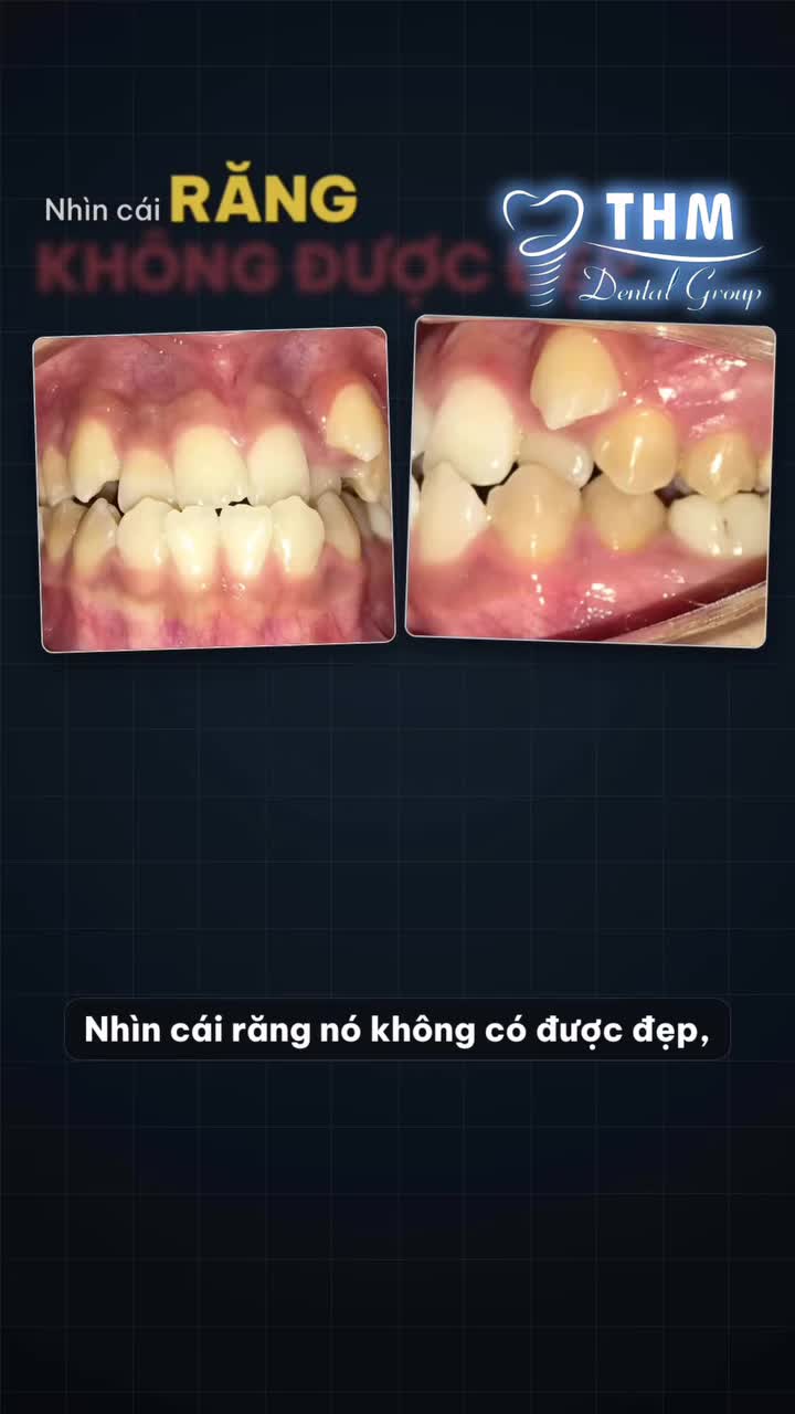 NỤ CƯỜI CỦA THƯ NGÀY THÁO NIỀNG – CÓ CẢ TÌNH THƯƠNG CỦA MẸ