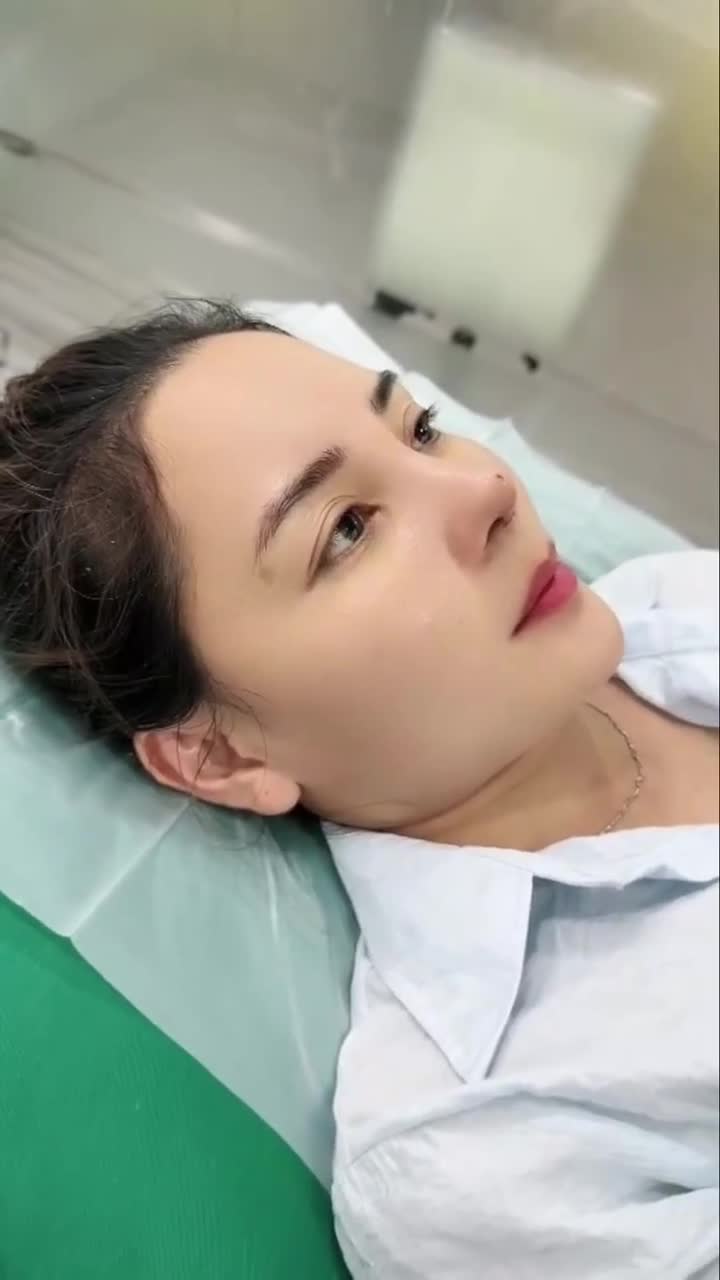 SỬA LẠI MŨI HỎNG SAU 3 NGÀY SẼ NHƯ THẾ NÀO???