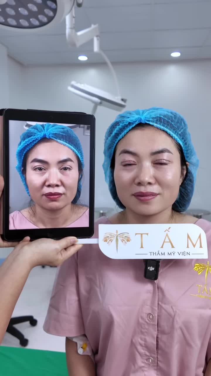 Cùng xem kết quả của ca hạ size, cân chỉnh lại mí Ấn Độ đã từng trending một thời sẽ như thế nào nhé!