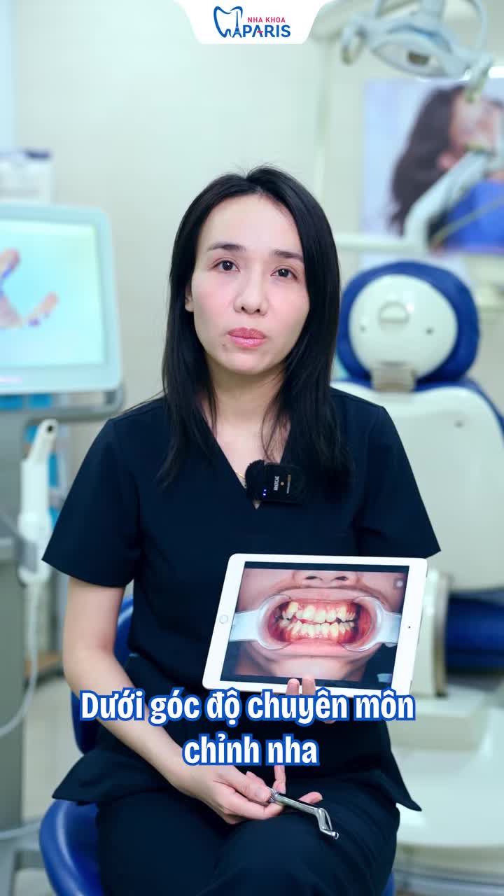 NIỀNG RĂNG CHEN CHÚC: CÓ BẮT BUỘC PHẢI NHỔ RĂNG?