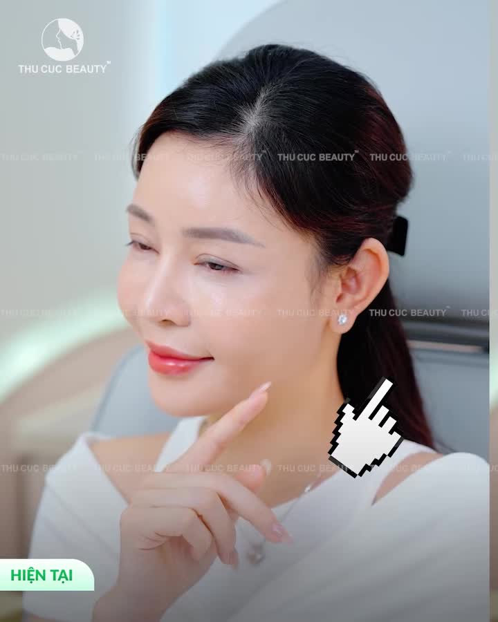 XÓA MỜ NÁM SẠM - LẤY LẠI LÀN DA SÁNG MỊN KHÔNG TÌ VẾT!