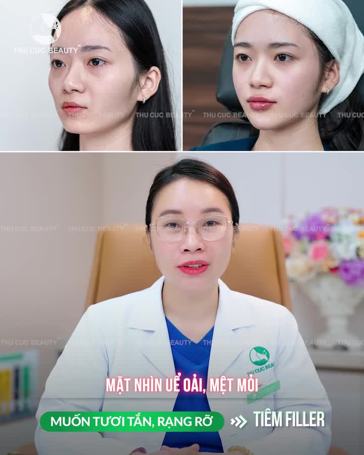 Nhiều bạn thắc mắc: Filler có thật sự thần thánh đến thế không? Bác sĩ khẳng định luôn là: CÓ, nếu bạn làm đúng cách.