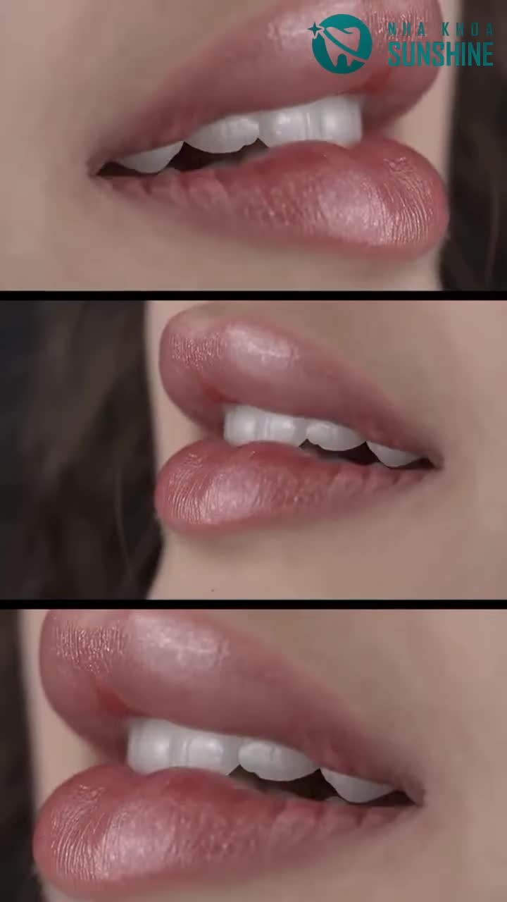 "ĐIỀU GÌ LÀM BẠN LO NGẠI NHẤT KHI QUYẾT ĐỊNH BỌC RĂNG SỨ?"