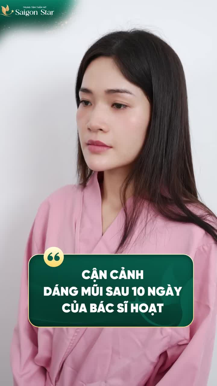 CẬN CẢNH DÁNG MŨI “ĐẸP NÉT” SAU 10 NGÀY – NHÌN LÀ MUỐN KHOE GÓC NGHIÊNG