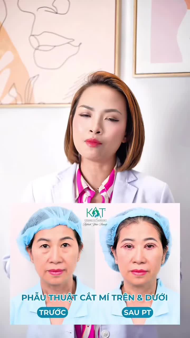 MỚI NHẤN MÍ, CẮT MÍ SAO MẮT SƯNG NỀ, CHƯA ĐỀU NHAU?