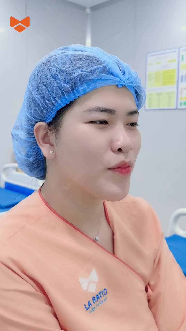 Mấy điểm cho ca Nâng mũi không băng nẹp này đây cả nhà
