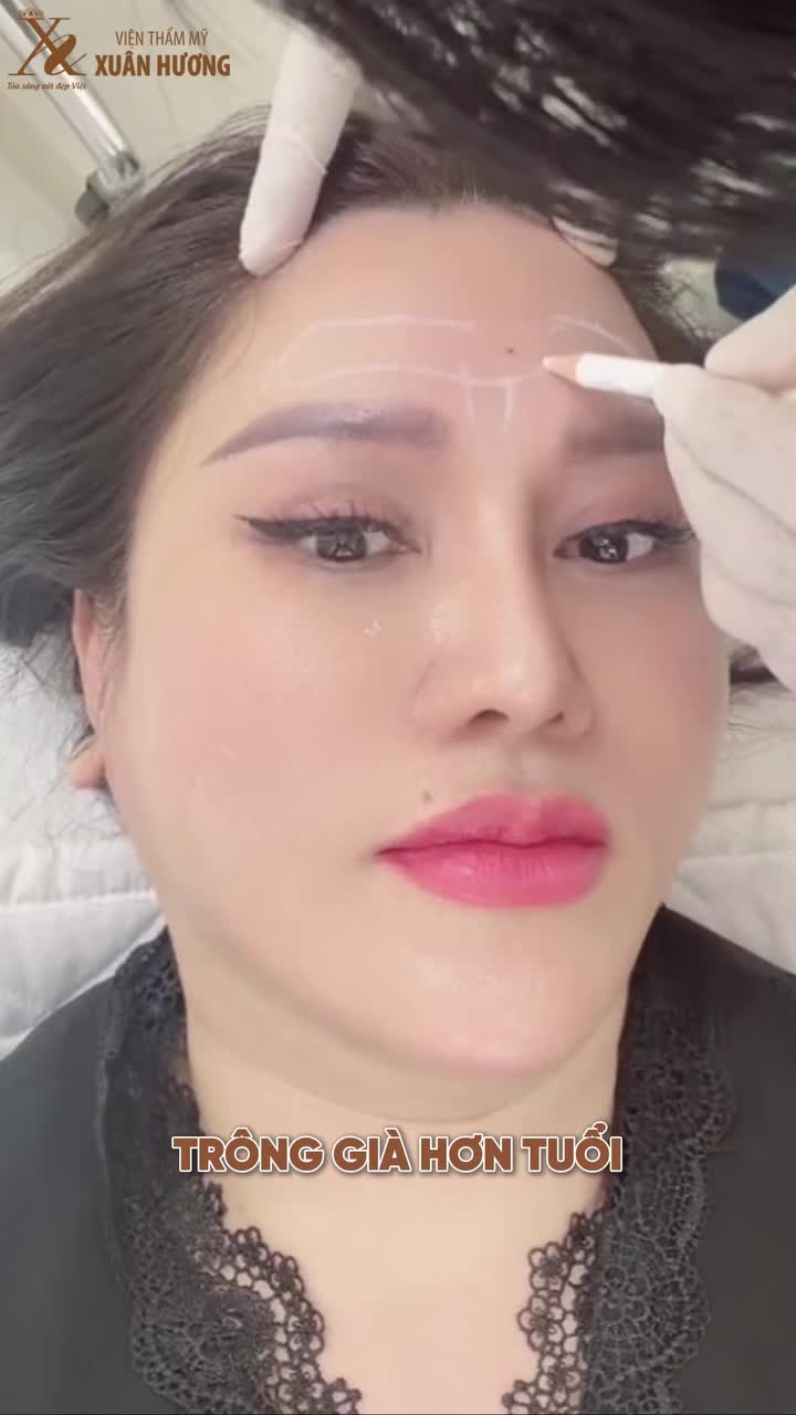 TRÁN ĐẸP TỰ NHIÊN – BÍ QUYẾT NẰM Ở ĐÂU?
