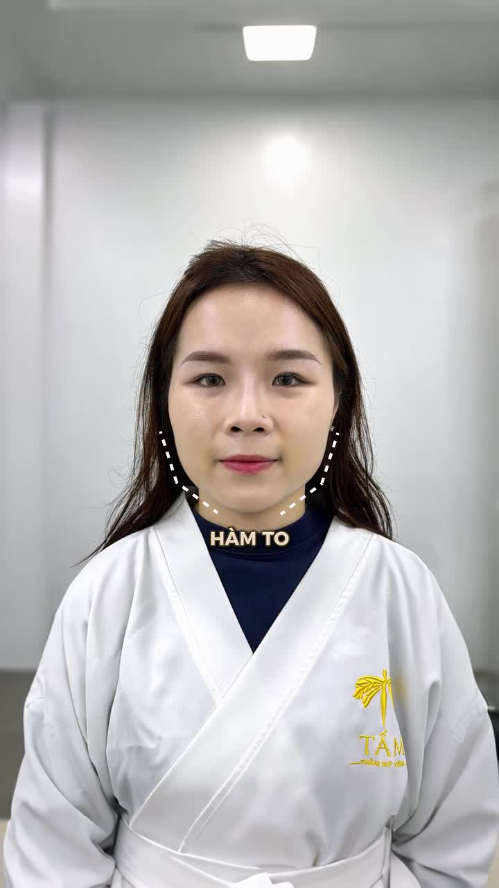So với trải nghiệm tiêm Botox trước đây, phương pháp gọn hàm Perfect Face Lift tại Tấm đã mang lại hiệu quả cải thiện đường nét gương mặt rõ rệt hơn rất nhiều theo chia sẻ của chị khách đó ạ.