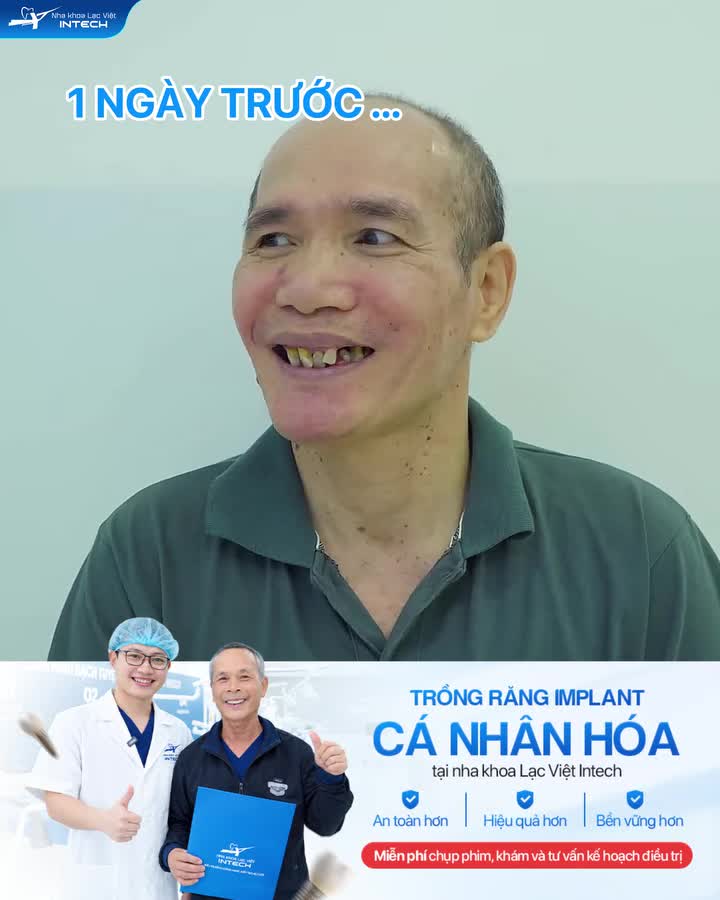 Lắp hàm tạm sau 1 ngày phẫu thuật cho khách hàng Đào Quang Thủy từ Hàn Quốc về Việt Nam trồng răng: