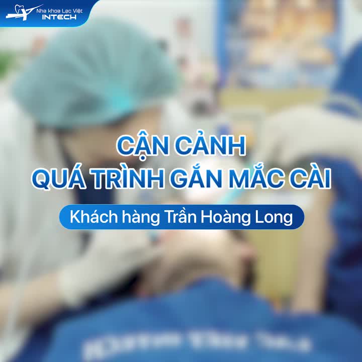 CẬN CẢNH QUÁ TRÌNH GẮN MẮC CÀI NIỀNG RĂNG CHO KHÁCH HÀNG TRẦN HOÀNG LONG