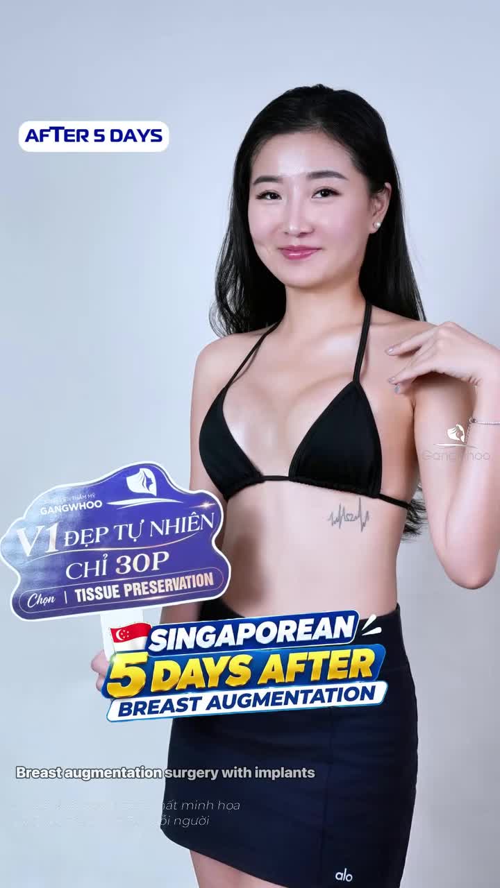 Cô nàng Singapore comeback đầy tự tin, khoe đường cong mới và chia sẻ trải nghiệm thực tế chỉ sau 5 ngày nâng vòng 1 tại Gangwhoo