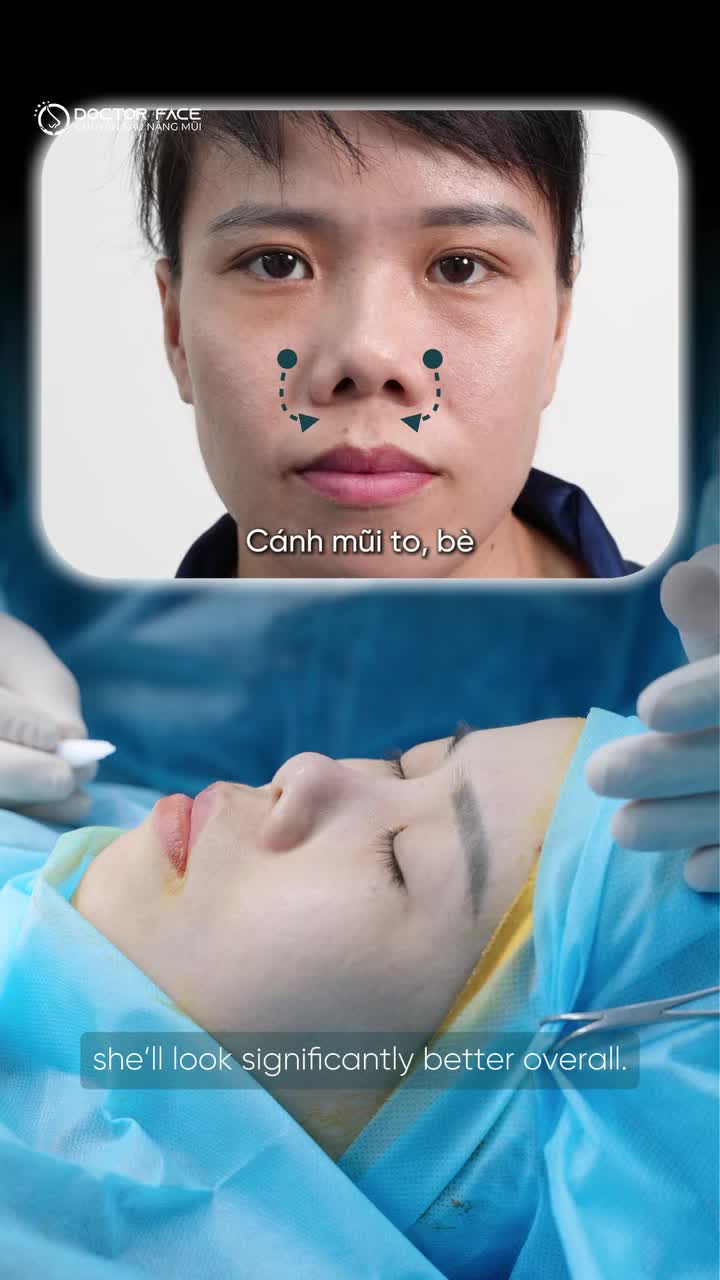 Mũi ngắn, lỗ mũi không đều thì nên thay đổi thế nào để tổng thể nhìn cân đối hơn?