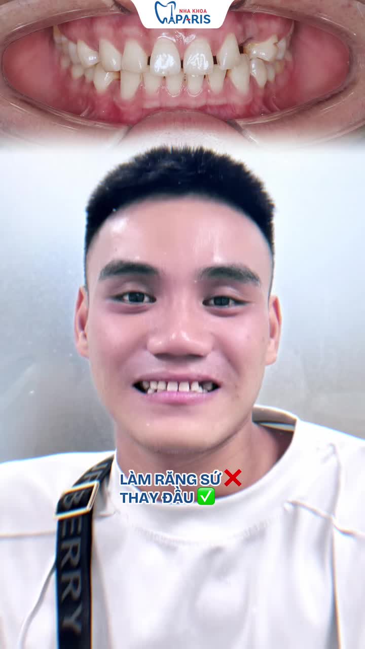 NỤ CƯỜI MỚI CÓ ĐÁNG ĐỂ THAY ĐỔI?