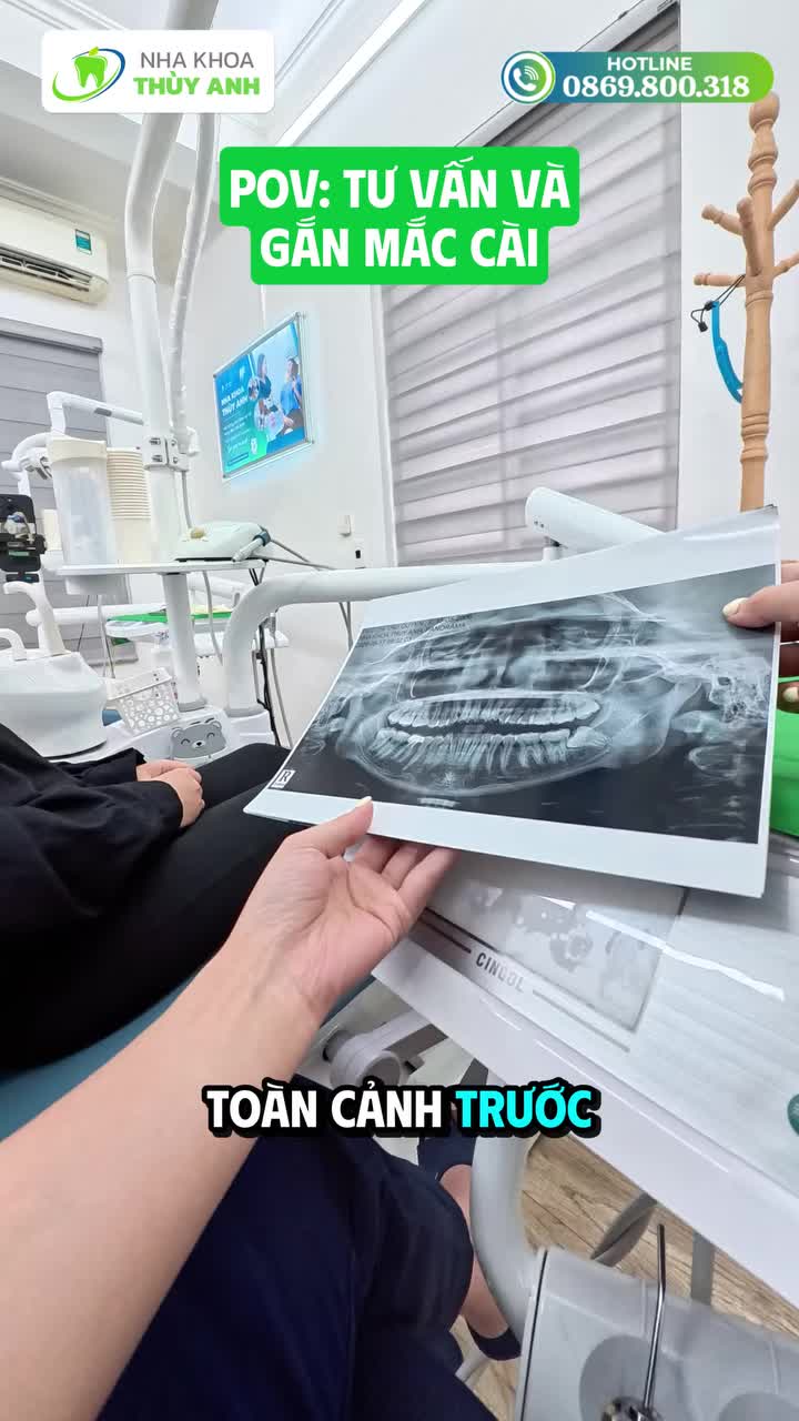 HÔM NAY, BẠN CHÍNH THỨC BẮT ĐẦU HÀNH TRÌNH NIỀNG RĂNG